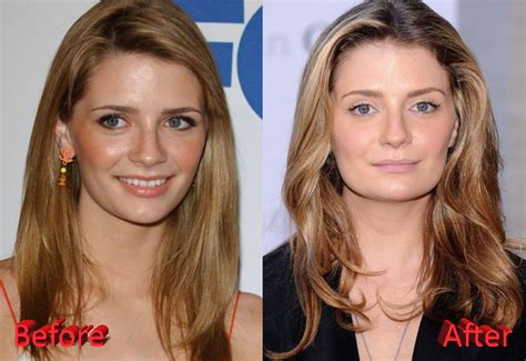 misha barton|mischa barton before and after.